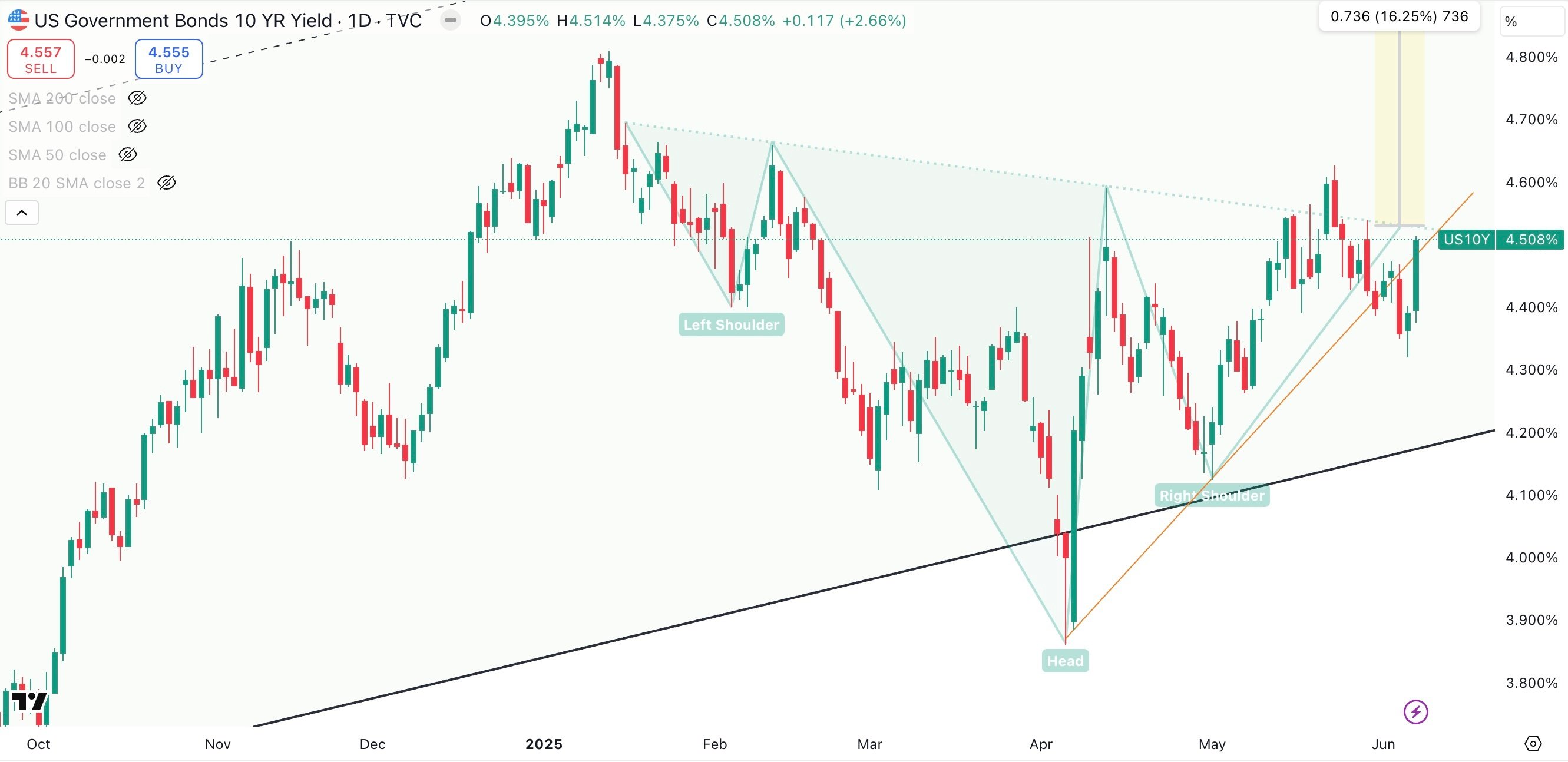US 10 Year Government Bond Yield Daily